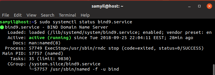 You are currently viewing Как актуализирах файла с корените  DNS сървъри в bind
